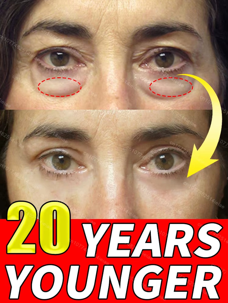 Instantly Removes under Eye Bags, Reduces Fine Wrinkles, Improves Skin Elasticity, Eliminates Dark Circles, Brightens the Eye Ar