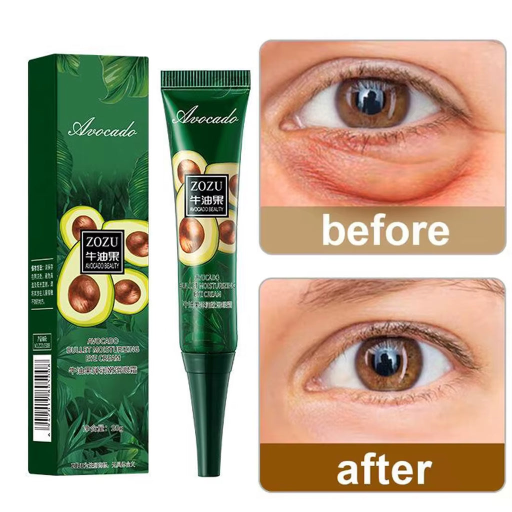 Avocado Eye Cream anti Dark Circles Removal Eye Bags Puffiness Moisturizing anti Wrinkle Eyes Creams Skin Care Prdoucts