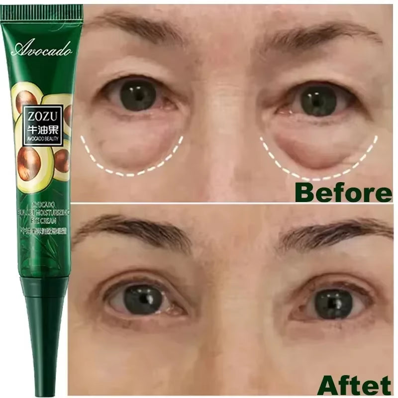 Instant Remove Wrinkles Eye Cream Fade Eye Fine Line anti Aging Dark Circles Bags Puffiness Tighten under Eyes Skin Care 2024