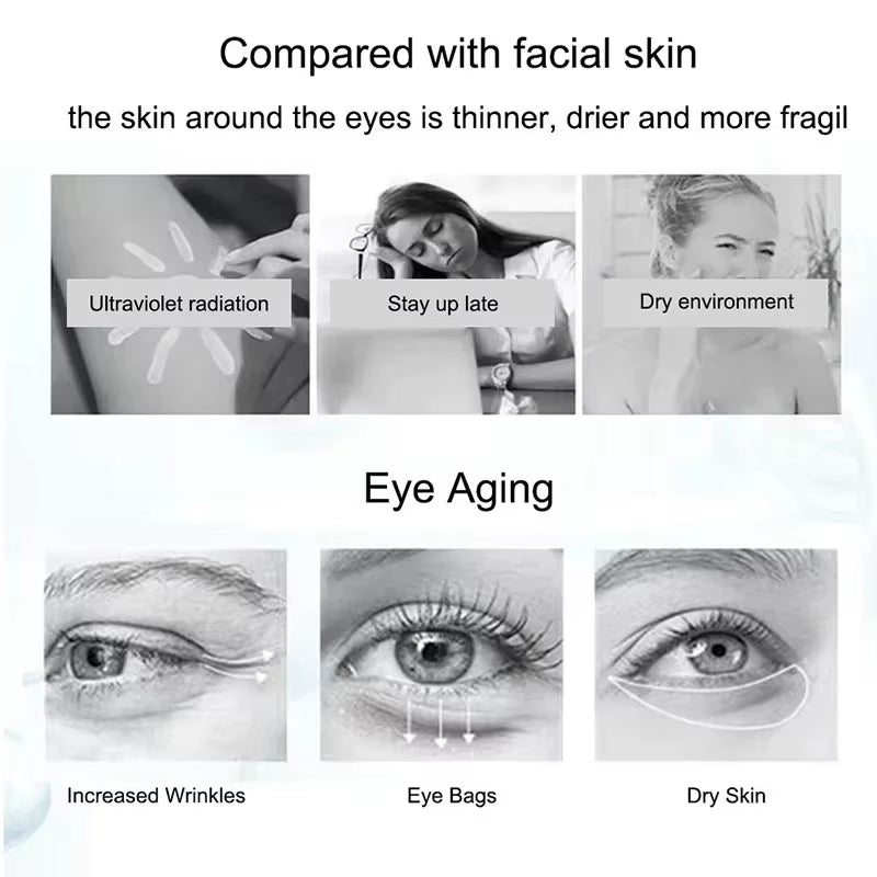 Nicotinamide Eyes Cream Dark Circles Remove Eye Bags under Eye Hyaluronic Acid Moisturizing Serum against Puffiness Eye Care Gel