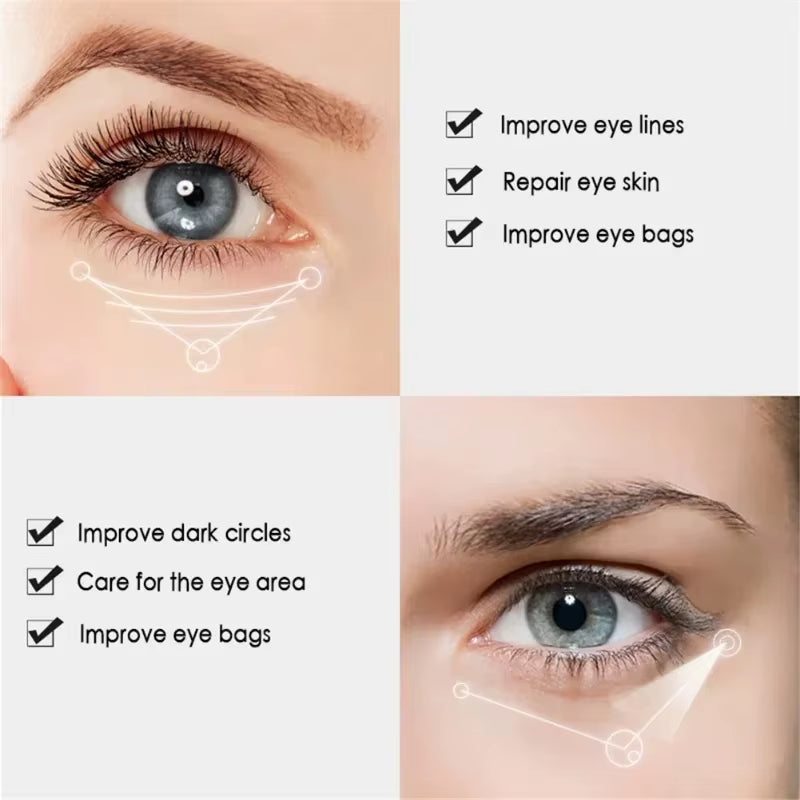 Nicotinamide Eyes Cream Dark Circles Remove Eye Bags under Eye Hyaluronic Acid Moisturizing Serum against Puffiness Eye Care Gel