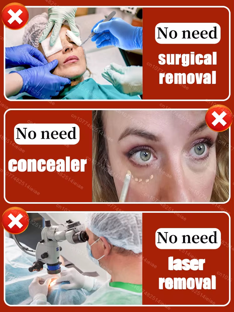 Instantly Removes under Eye Bags, Reduces Fine Wrinkles, Improves Skin Elasticity, Eliminates Dark Circles, Brightens the Eye Ar