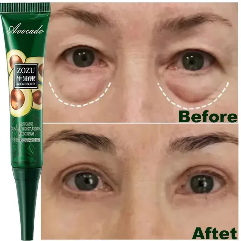 Avocado Eye Cream anti Dark Circles Removal Eye Bags Puffiness Moisturizing anti Wrinkle Eyes Creams Skin Care Prdoucts