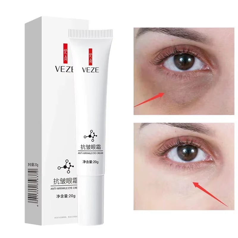 Nicotinamide Eyes Cream Dark Circles Remove Eye Bags under Eye Hyaluronic Acid Moisturizing Serum against Puffiness Eye Care Gel